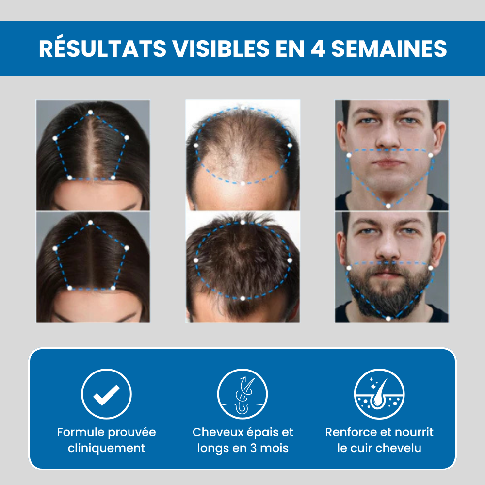 Sérum de croissance au romarin FoliLab
