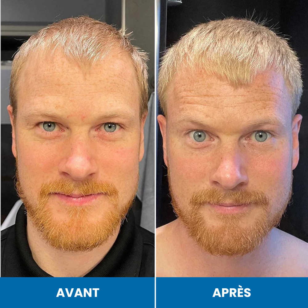 Sérum de croissance au romarin FoliLab