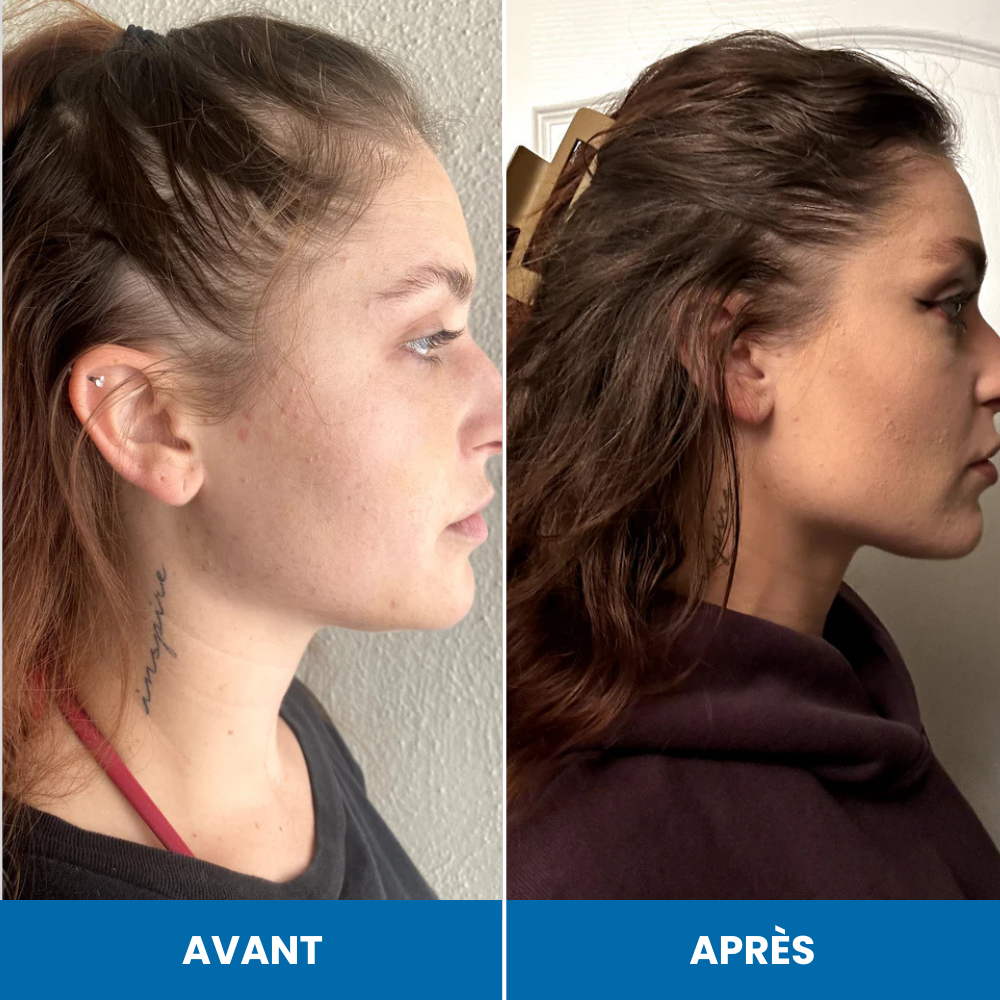 Sérum de croissance au romarin FoliLab