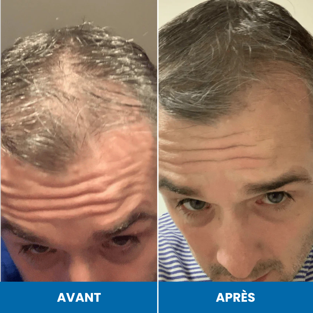 Sérum de croissance au romarin FoliLab