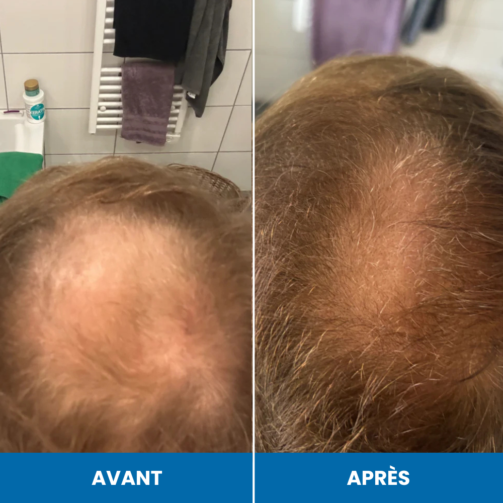 Sérum de croissance au romarin FoliLab