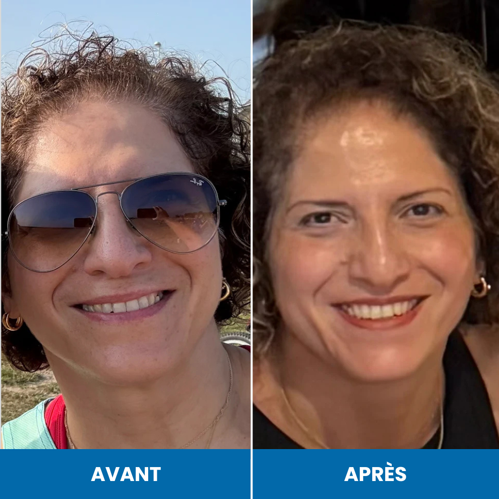 Sérum de croissance au romarin FoliLab